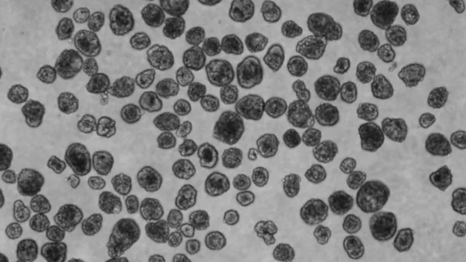 Cientistas criam pequenos robôs vivos feitos de células humanas | Mundo & História